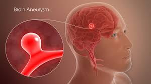 Medical Illustration