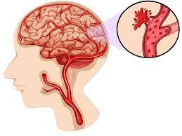 Medical Illustration