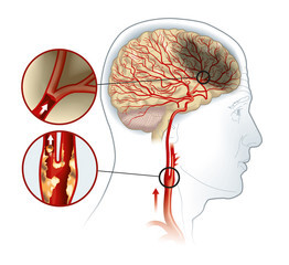 Medical Illustration