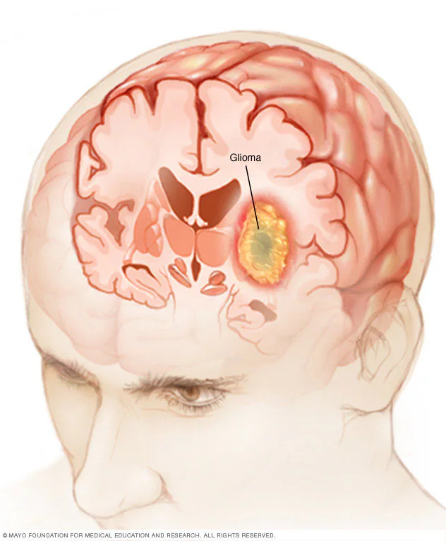 Medical Illustration