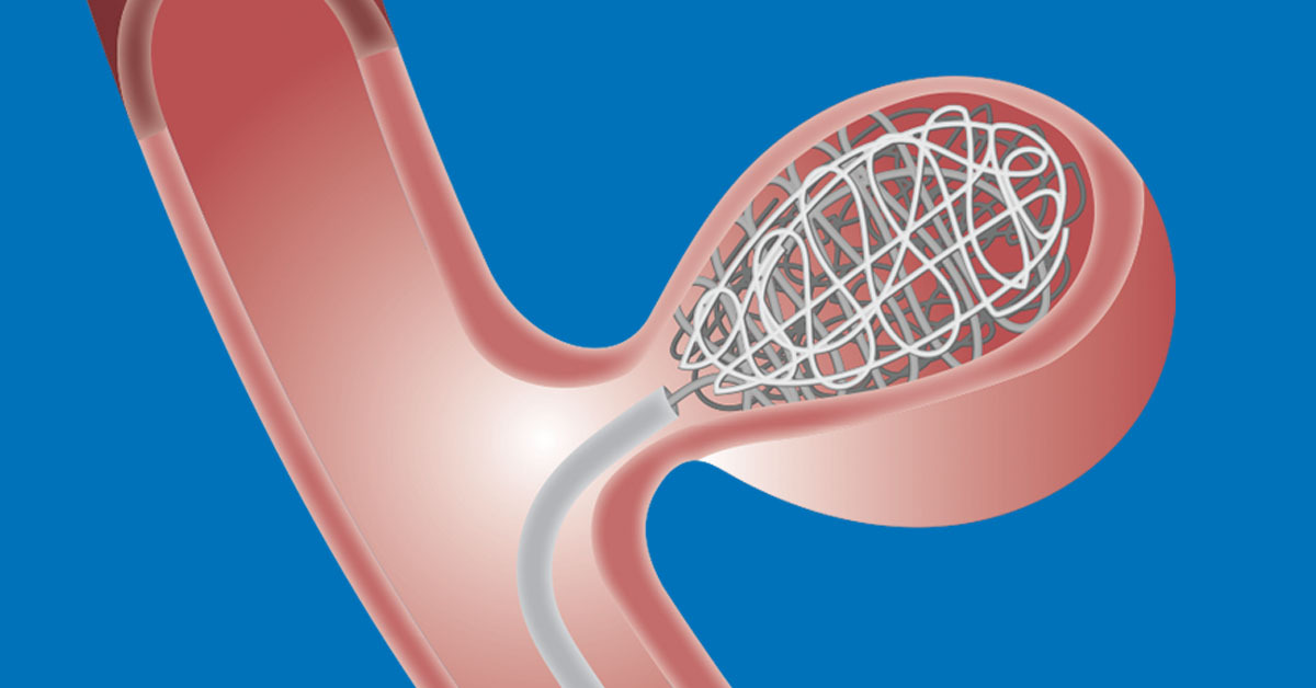 Medical Illustration