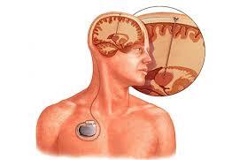 Medical Illustration