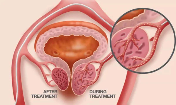 Medical Illustration